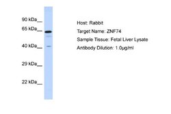 ZNF74 Antibody, Novus Biologicals 100 &mu;L; Unconjugated:Antibodies, Polyclonal